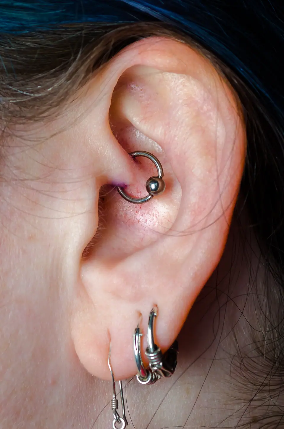 Piercing de daith reciente en el pliegue interno de la oreja